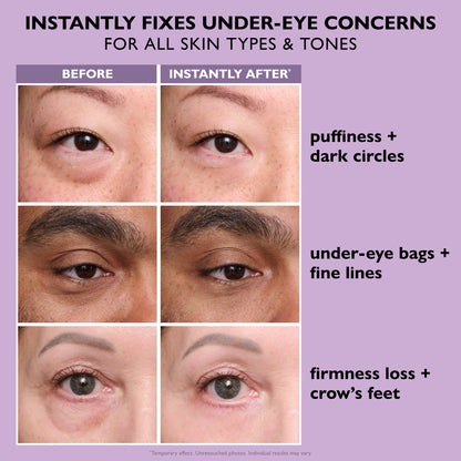 Instant Eye Lift Magic