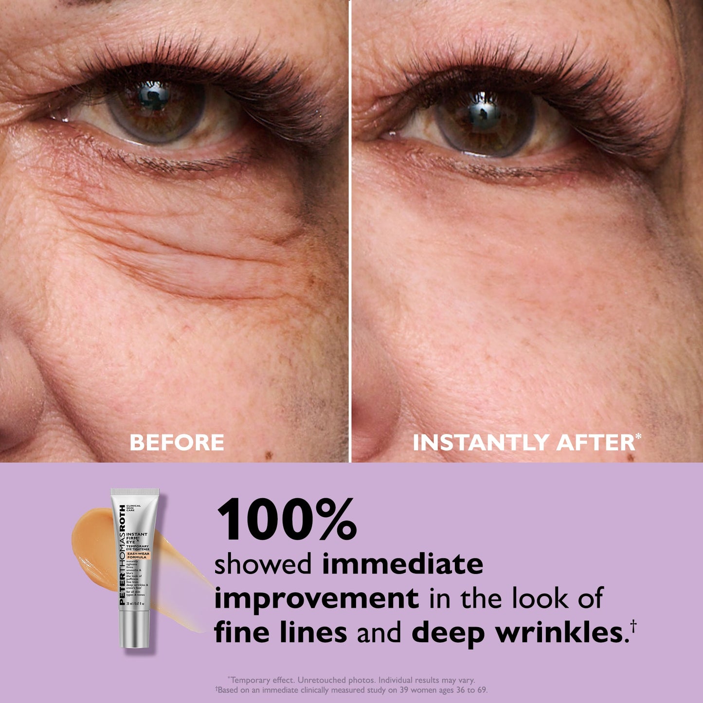 Instant Eye Lift Magic